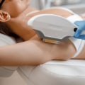 Understanding IPL Therapy for Cosmetic Treatments in Glasgow