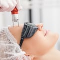 Laser Resurfacing: An Overview of Non-Invasive Skin Treatments in Glasgow