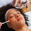 Understanding Chemical Peels: A Comprehensive Guide to Non-Invasive Facial Treatments