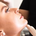 Understanding Botox Injections: A Guide to Non-Invasive Facial Treatments in Glasgow