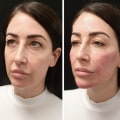 Looking at Different Angles on Cosmetic Treatments in Glasgow: A Comprehensive Guide