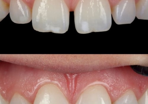 Word-of-mouth Recommendations for Cosmetic Treatments in Glasgow: A Comprehensive Guide