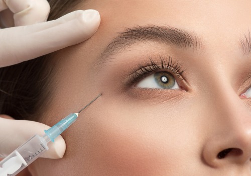 All You Need to Know About Brow Lifts