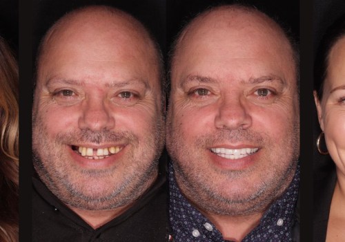Before-and-after photos of previous patients: A Comprehensive Guide to Finding Reputable Cosmetic Treatment Providers in Glasgow