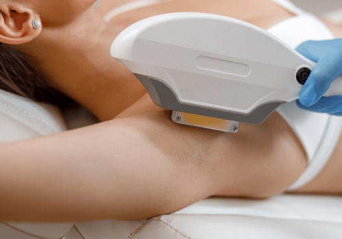 Understanding IPL Therapy for Cosmetic Treatments in Glasgow