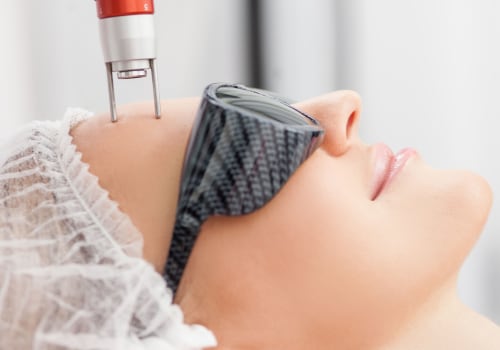 Laser Resurfacing: An Overview of Non-Invasive Skin Treatments in Glasgow