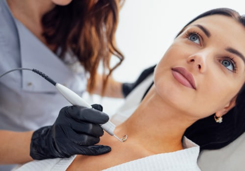 Understanding Cryotherapy: A Guide to Non-Invasive Cosmetic Treatments in Glasgow