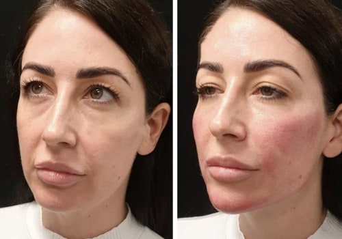 Looking at Different Angles on Cosmetic Treatments in Glasgow: A Comprehensive Guide