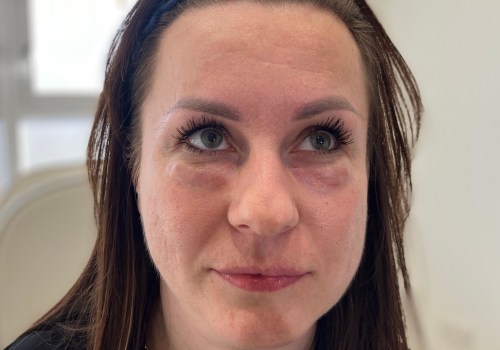 Possible Risks and Complications of Cosmetic Treatments in Glasgow